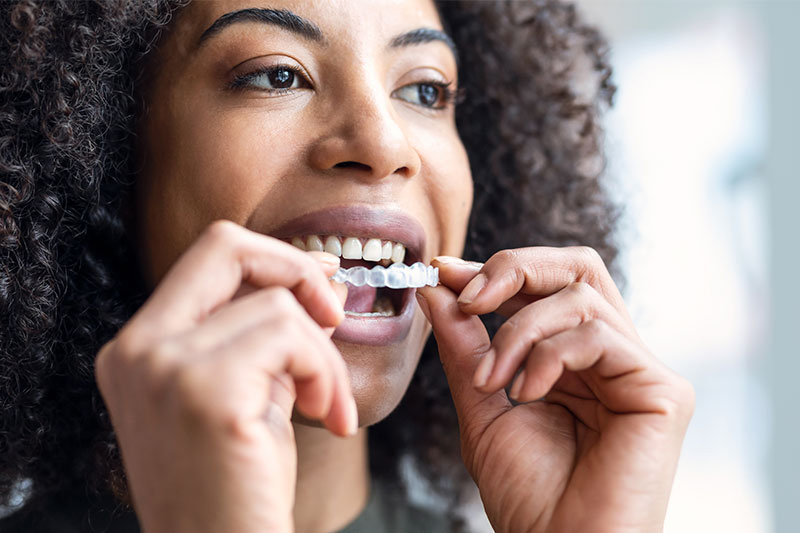 Clear Aligners in Hackettstown